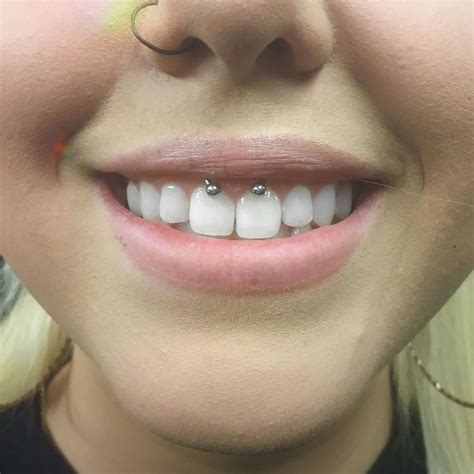 does smiley piercing hurt